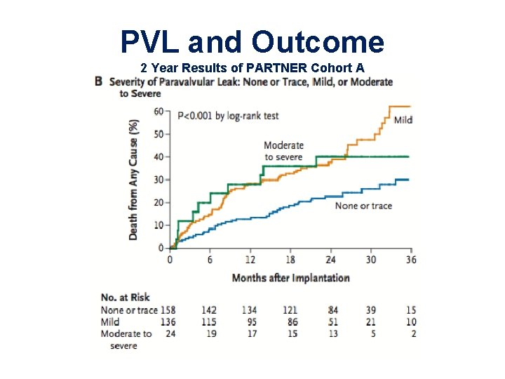 PVL and Outcome 2 Year Results of PARTNER Cohort A PVL and Outcome 2 Year Results of PARTNER Cohort A