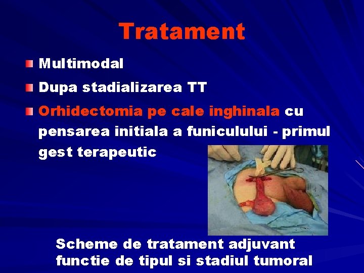 Tratament Multimodal Dupa stadializarea TT Orhidectomia pe cale inghinala cu pensarea initiala a funiculului