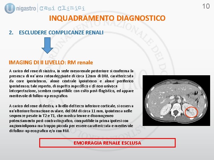 10 INQUADRAMENTO DIAGNOSTICO 2. ESCLUDERE COMPLICANZE RENALI IMAGING DI II LIVELLO: RM renale A