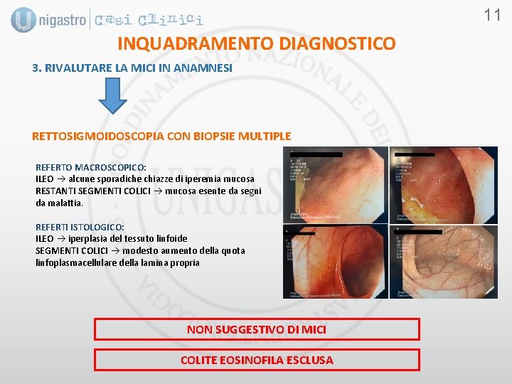 11 INQUADRAMENTO DIAGNOSTICO 3. RIVALUTARE LA MICI IN ANAMNESI RETTOSIGMOIDOSCOPIA CON BIOPSIE MULTIPLE REFERTO