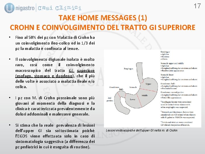 17 TAKE HOME MESSAGES (1) CROHN E COINVOLGIMENTO DEL TRATTO GI SUPERIORE • Fino