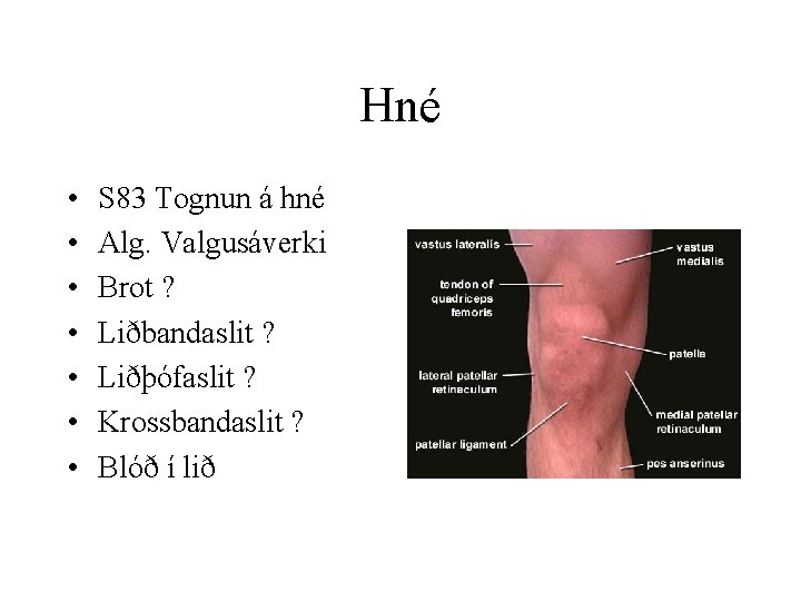 Hné • • S 83 Tognun á hné Alg. Valgusáverki Brot ? Liðbandaslit ?