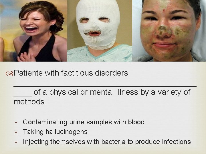  Patients with factitious disorders_____________________ of a physical or mental illness by a variety