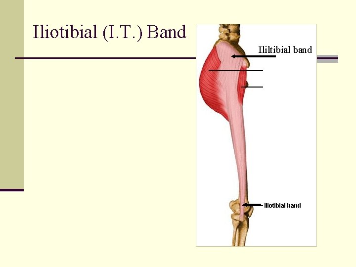Iliotibial (I. T. ) Band Ililtibial band 