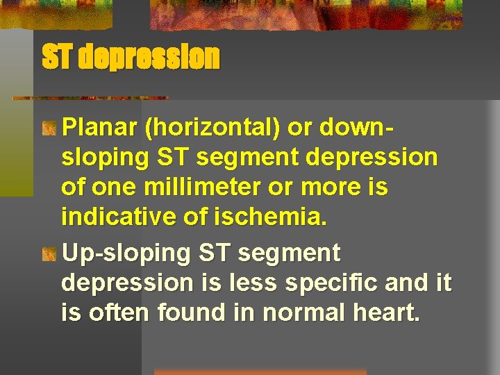 ST depression Planar (horizontal) or downsloping ST segment depression of one millimeter or more