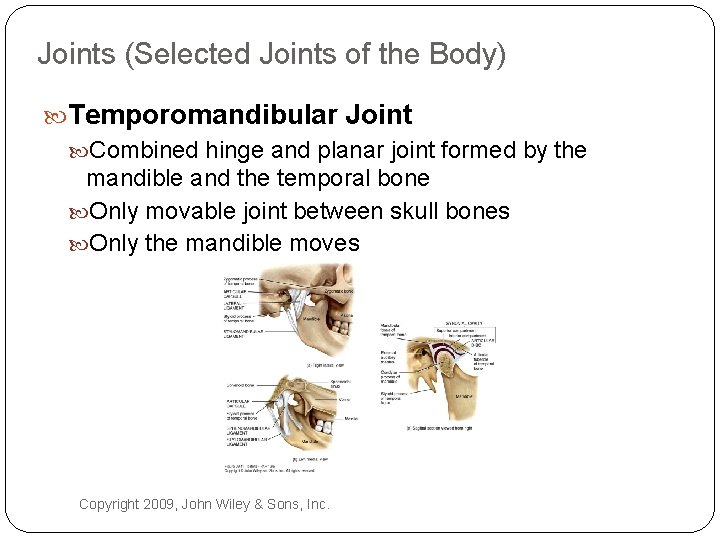 Joints (Selected Joints of the Body) Temporomandibular Joint Combined hinge and planar joint formed