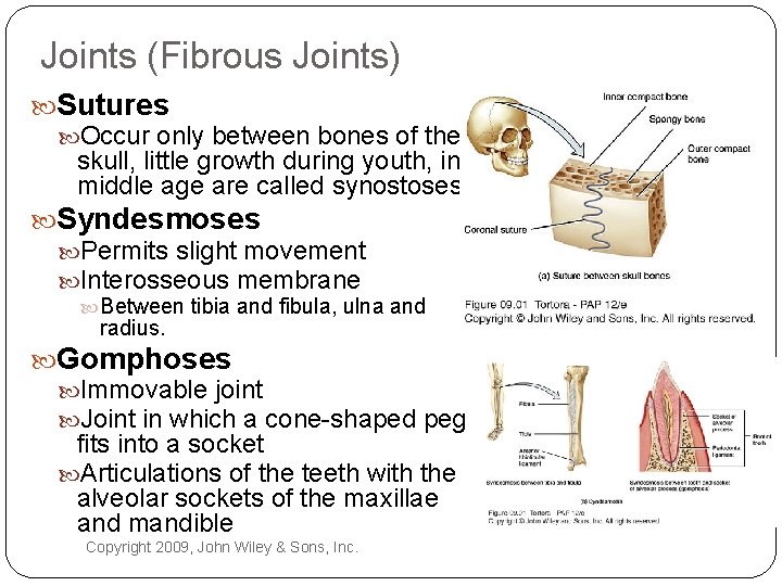 Joints (Fibrous Joints) Sutures Occur only between bones of the skull, little growth during