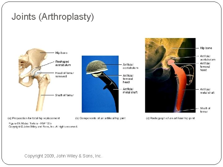 Joints (Arthroplasty) Copyright 2009, John Wiley & Sons, Inc. 