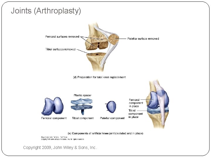 Joints (Arthroplasty) Copyright 2009, John Wiley & Sons, Inc. 