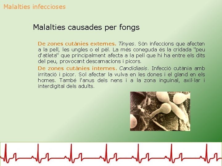 Malalties infeccioses Malalties causades per fongs De zones cutànies externes. Tinyes. Són infeccions que