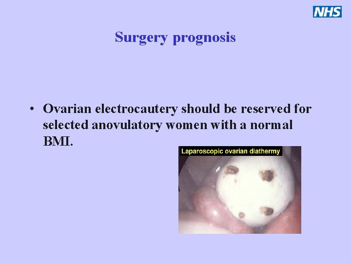 Surgery prognosis • Ovarian electrocautery should be reserved for selected anovulatory women with a