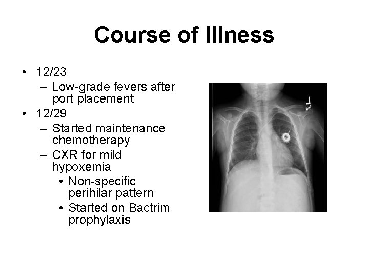 Course of Illness • 12/23 – Low-grade fevers after port placement • 12/29 –