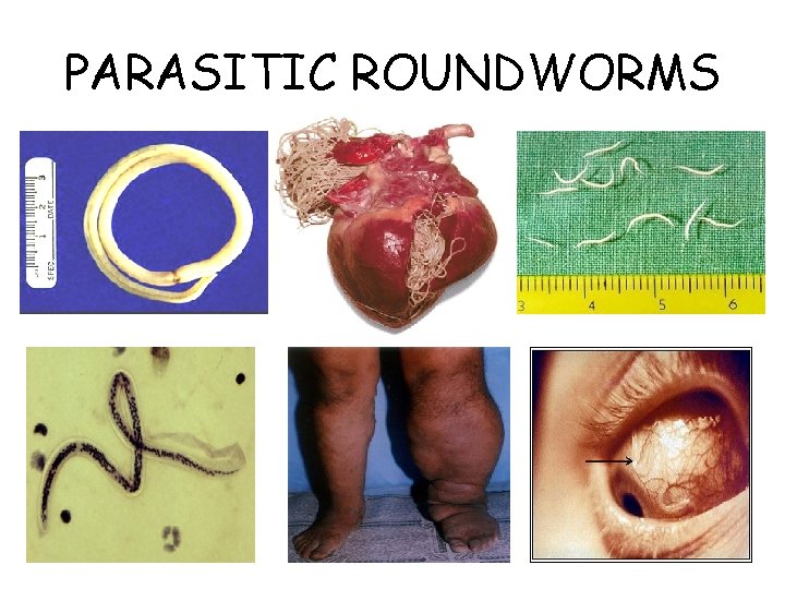 PARASITIC ROUNDWORMS 