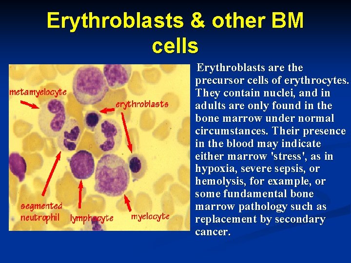 Erythroblasts & other BM cells Erythroblasts are the precursor cells of erythrocytes. They contain