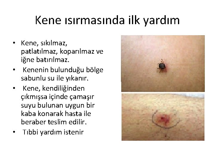 Zehrlenmeler Hazirlayan Neslhan Gmen Zehir Belirli Bir Miktarda