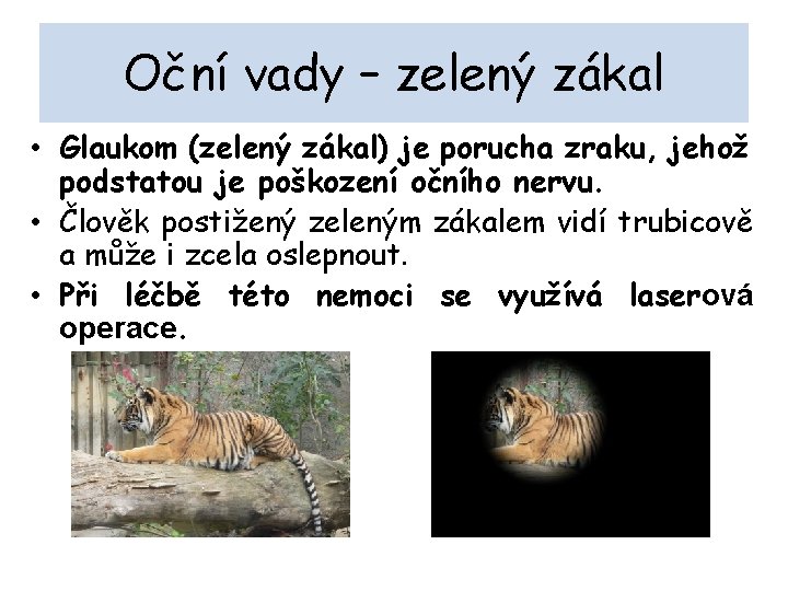 Oční vady – zelený zákal • Glaukom (zelený zákal) je porucha zraku, jehož podstatou