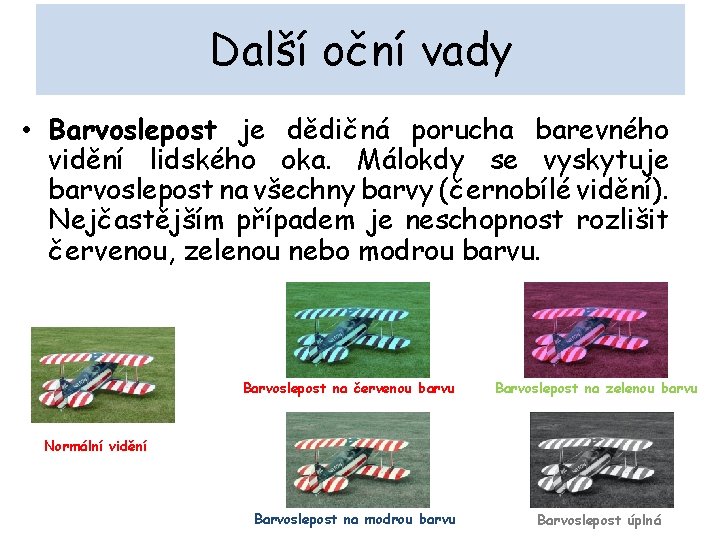 Další oční vady • Barvoslepost je dědičná porucha barevného vidění lidského oka. Málokdy se