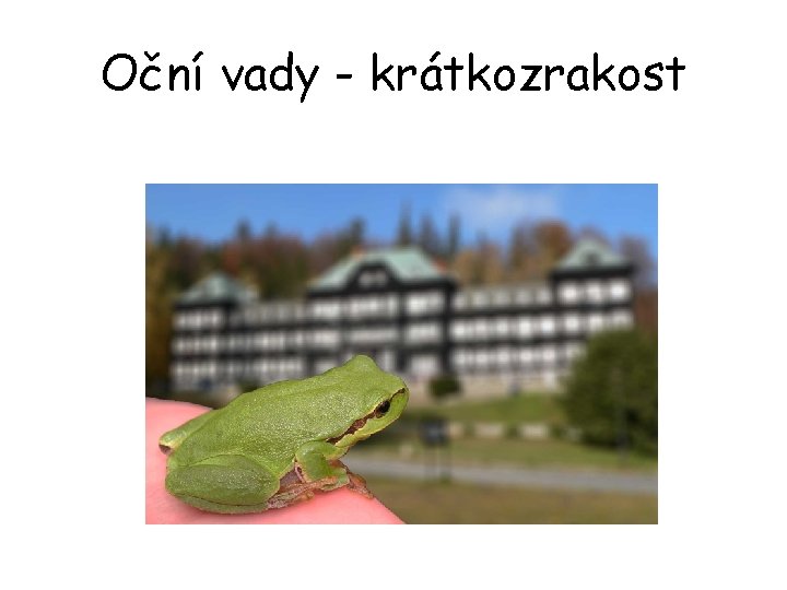 Oční vady - krátkozrakost 