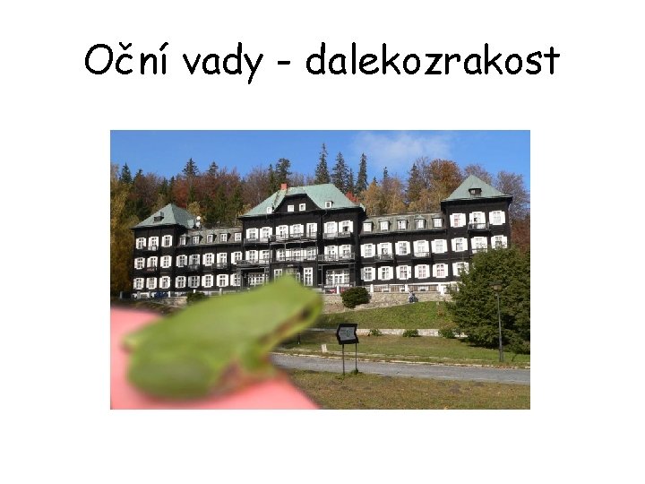 Oční vady - dalekozrakost 