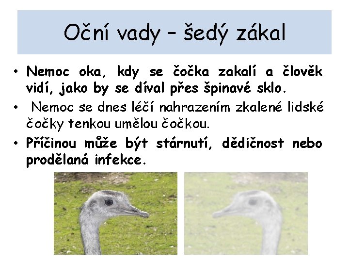 Oční vady – šedý zákal • Nemoc oka, kdy se čočka zakalí a člověk