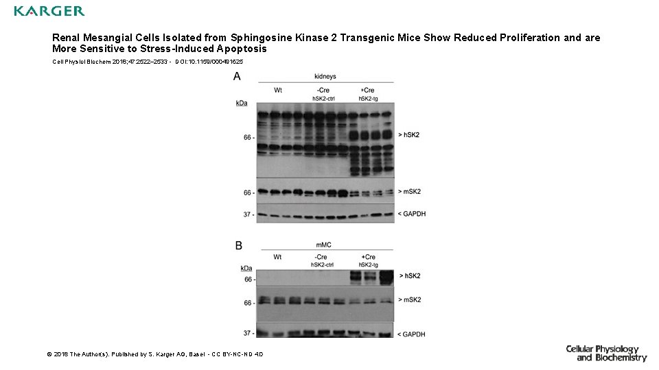 Renal Mesangial Cells Isolated from Sphingosine Kinase 2 Transgenic Mice Show Reduced Proliferation and