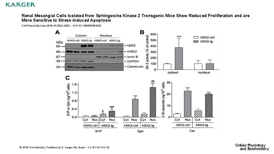 Renal Mesangial Cells Isolated from Sphingosine Kinase 2 Transgenic Mice Show Reduced Proliferation and