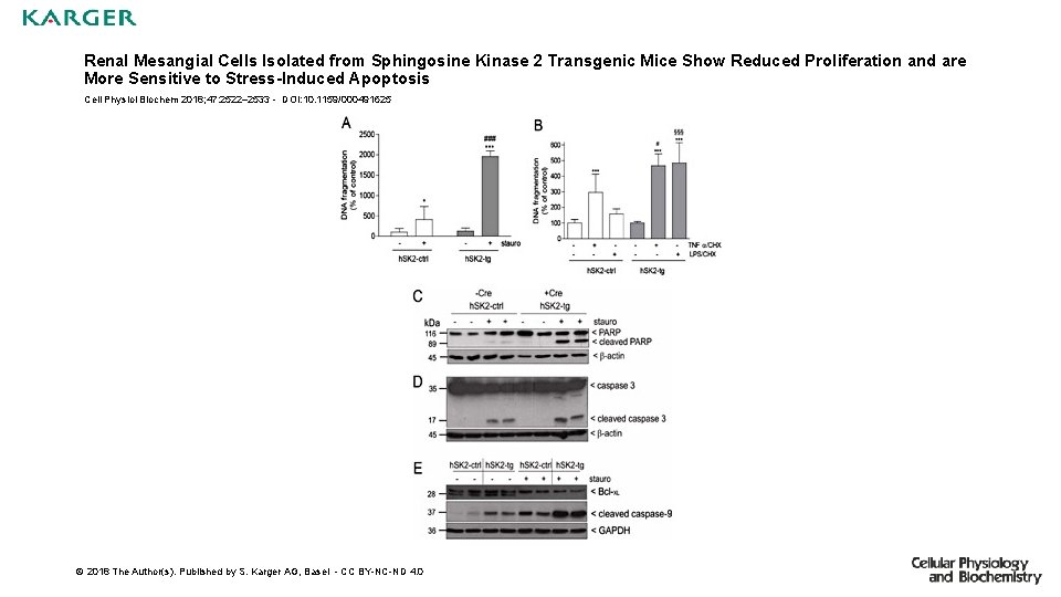 Renal Mesangial Cells Isolated from Sphingosine Kinase 2 Transgenic Mice Show Reduced Proliferation and