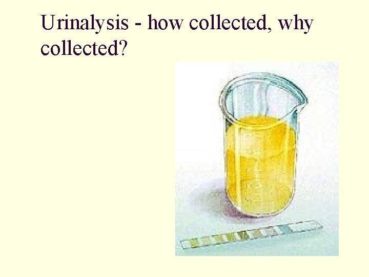 Urinalysis - how collected, why collected? 