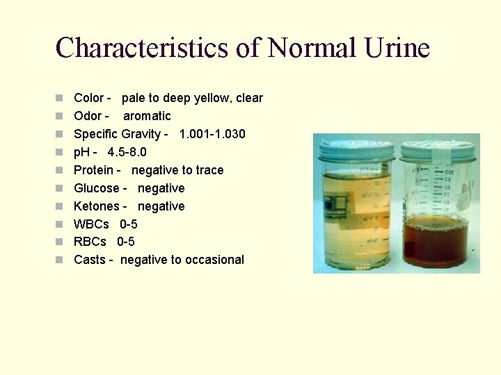 Characteristics of Normal Urine n Color - pale to deep yellow, clear n Odor