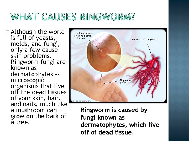 � Although the world is full of yeasts, molds, and fungi, only a few