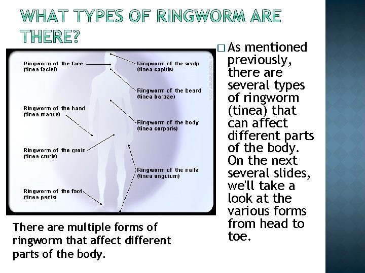 � As There are multiple forms of ringworm that affect different parts of the