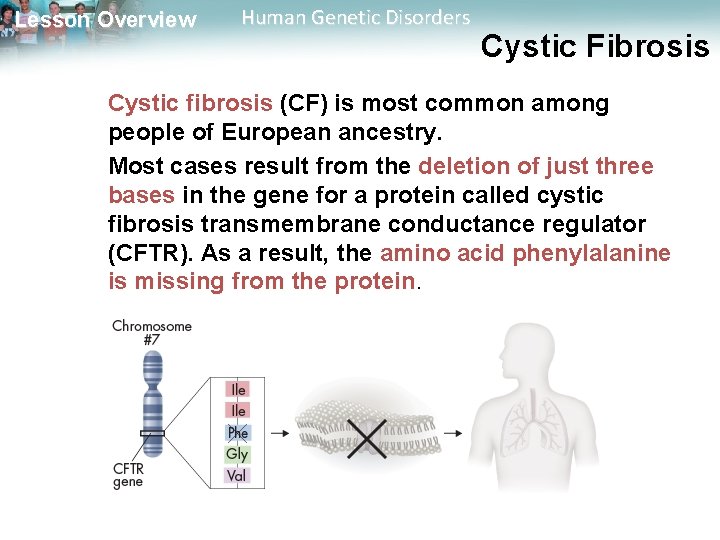 Lesson Overview Human Genetic Disorders Cystic Fibrosis Cystic fibrosis (CF) is most common among