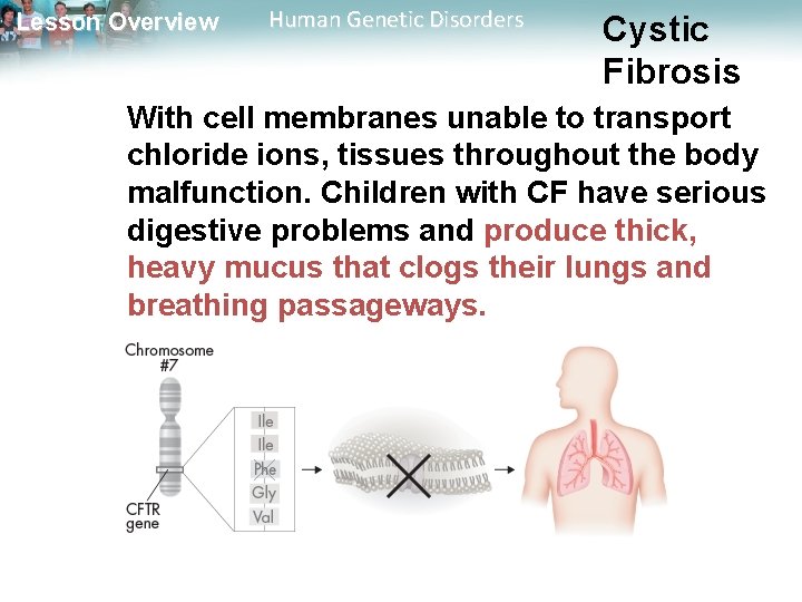Lesson Overview Human Genetic Disorders Cystic Fibrosis With cell membranes unable to transport chloride