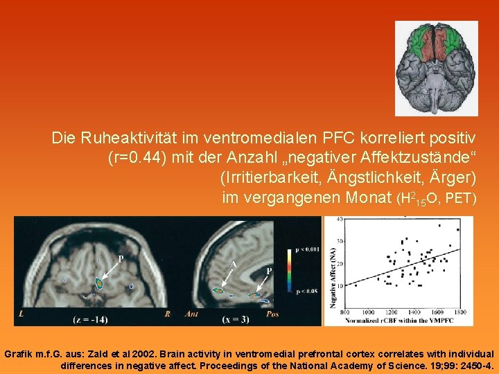 Die Ruheaktivität im ventromedialen PFC korreliert positiv (r=0. 44) mit der Anzahl „negativer Affektzustände“
