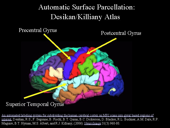 Automatic Surface Parcellation: Desikan/Killiany Atlas Precentral Gyrus Postcentral Gyrus Superior Temporal Gyrus An automated