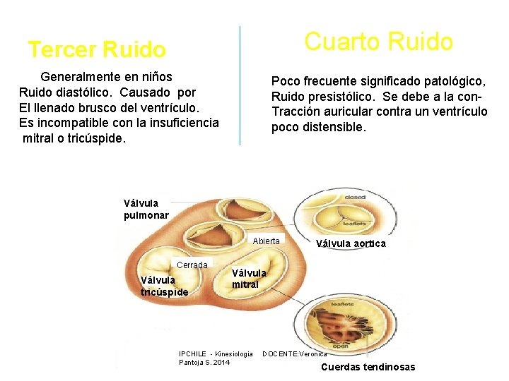 Cuarto Ruido Tercer Ruido Generalmente en niños Ruido diastólico. Causado por El llenado brusco