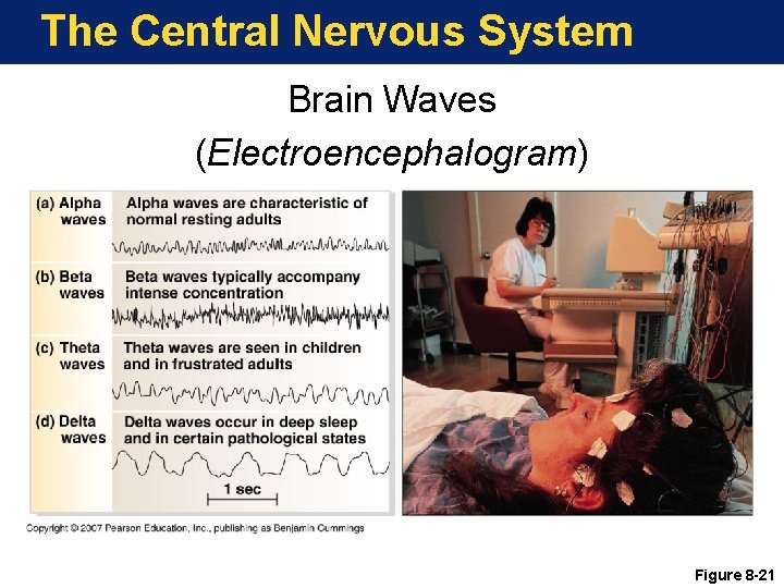 The Central Nervous System Brain Waves (Electroencephalogram) Figure 8 -21 