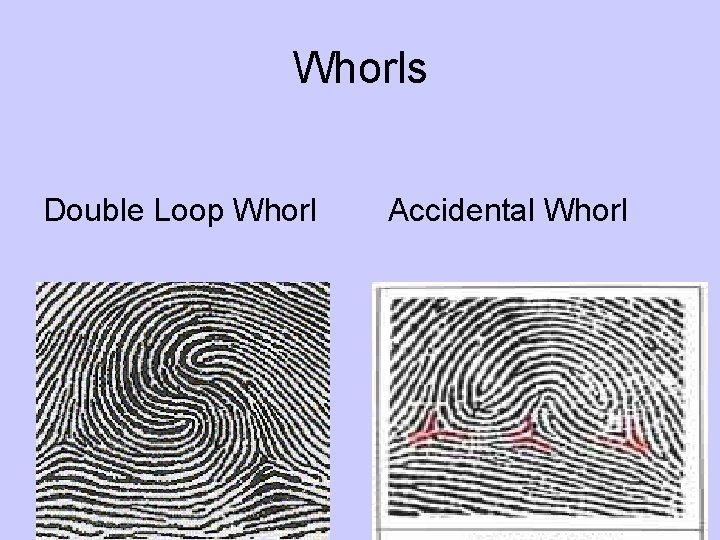 Whorls Double Loop Whorl Accidental Whorl 