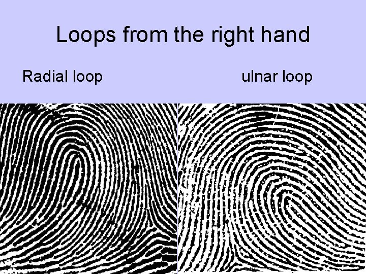 Loops from the right hand Radial loop ulnar loop 