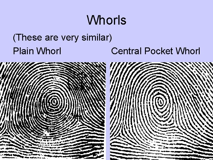 Whorls (These are very similar) Plain Whorl Central Pocket Whorl 