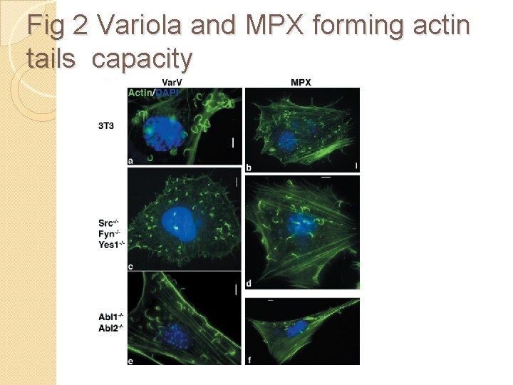 Fig 2 Variola and MPX forming actin tails capacity 