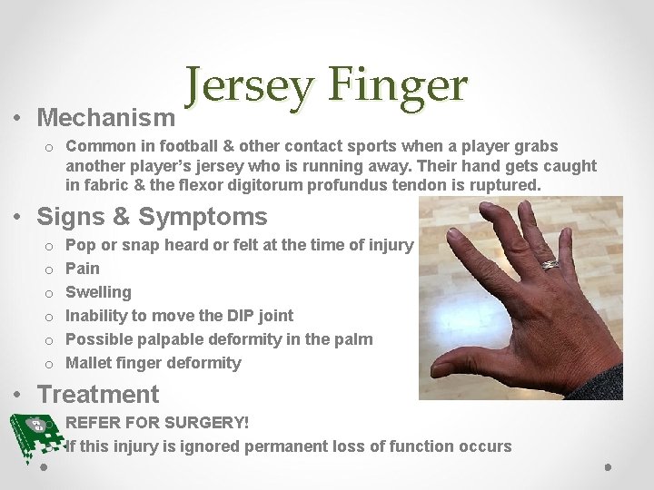  • Jersey Finger Mechanism o Common in football & other contact sports when