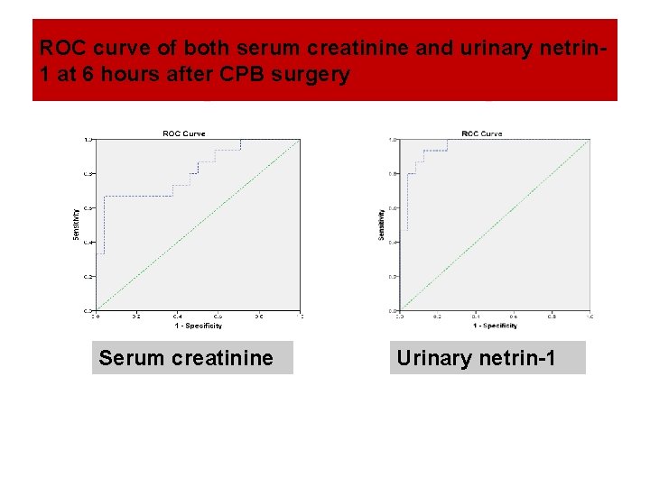 ROC curve of both serum creatinine and urinary netrin 1 at 6 hours after