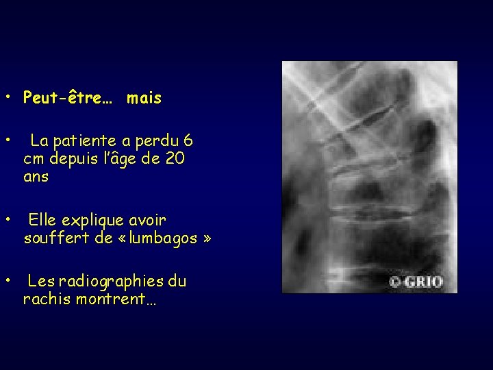  • Peut-être… mais • La patiente a perdu 6 cm depuis l’âge de