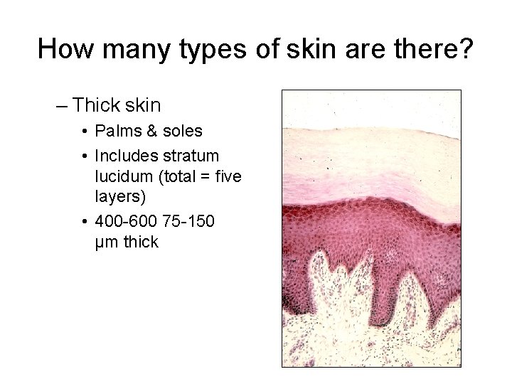 How many types of skin are there? – Thick skin • Palms & soles