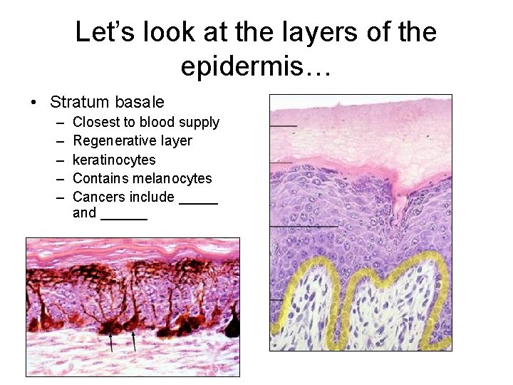 Let’s look at the layers of the epidermis… • Stratum basale – – –