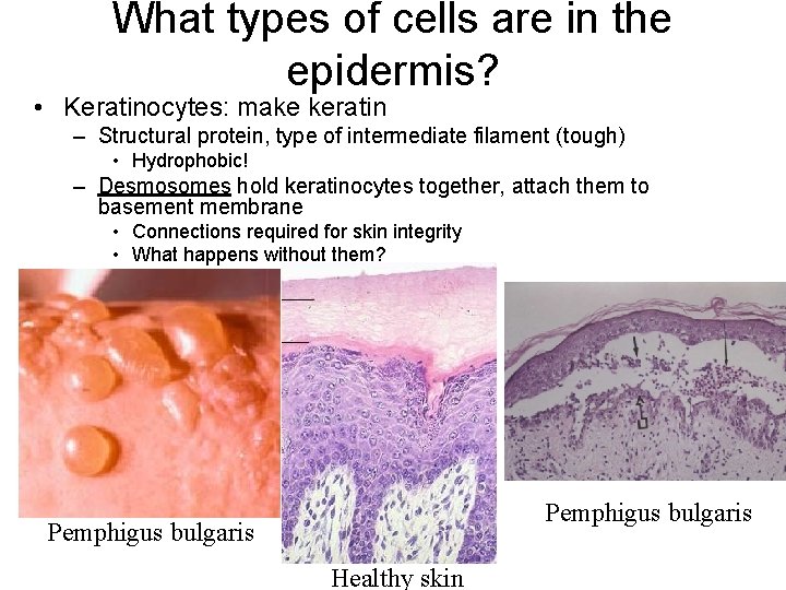 What types of cells are in the epidermis? • Keratinocytes: make keratin – Structural