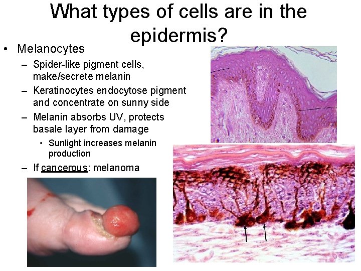 What types of cells are in the epidermis? • Melanocytes – Spider-like pigment cells,