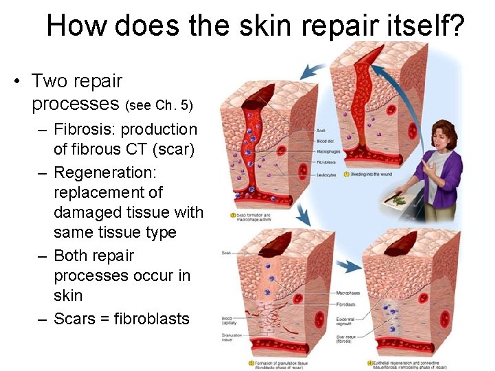 How does the skin repair itself? • Two repair processes (see Ch. 5) –