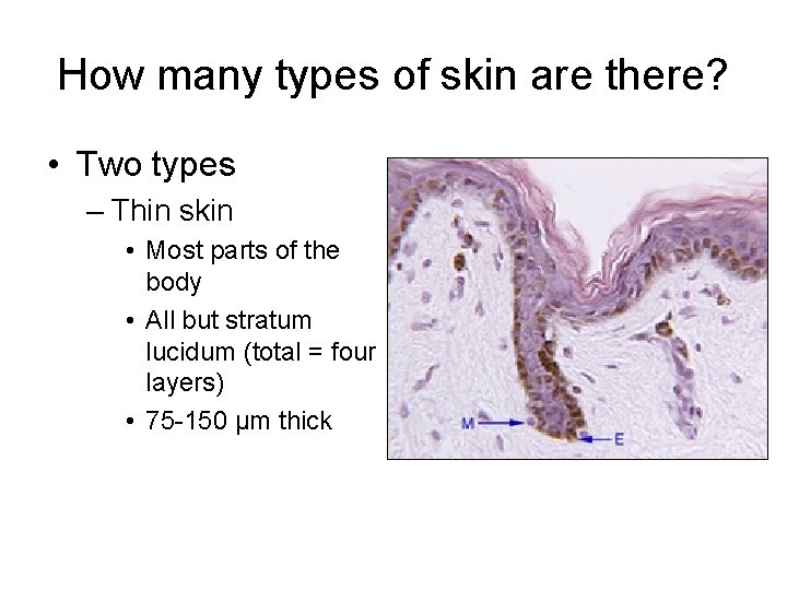 How many types of skin are there? • Two types – Thin skin •